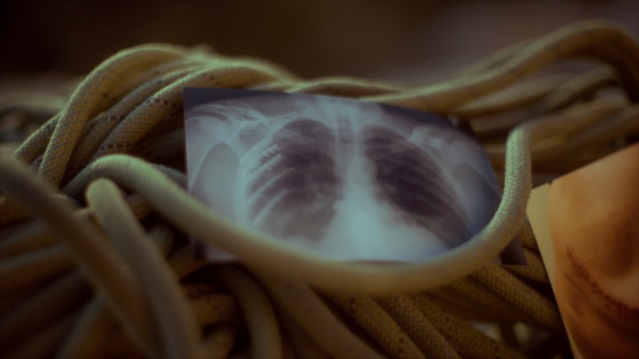A chest X-ray tucked into a coil of rope. Film still.